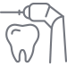 root-canal